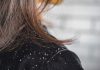 Eradicate The Problem Of Dandruff Once And For All