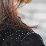 Eradicate The Problem Of Dandruff Once And For All