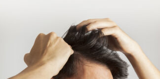 Hair Loss PRP Treatment in Delhi