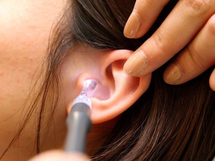 Guide to Earwax Removal & Ear Cleaning