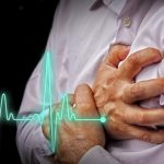 Signs Of Cardiac Arrest