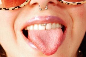 What Is Smiley Piercing?