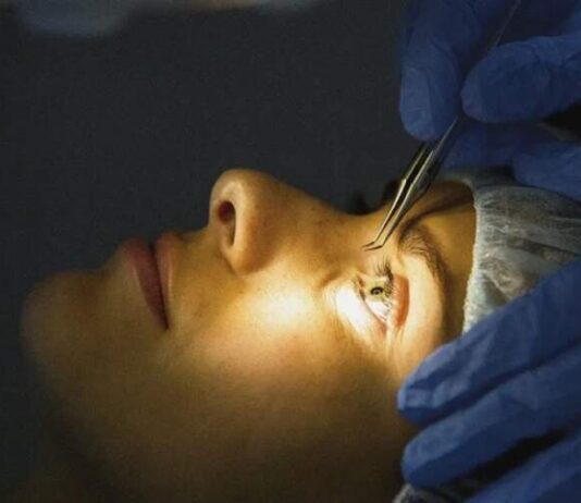 Lasik Surgery