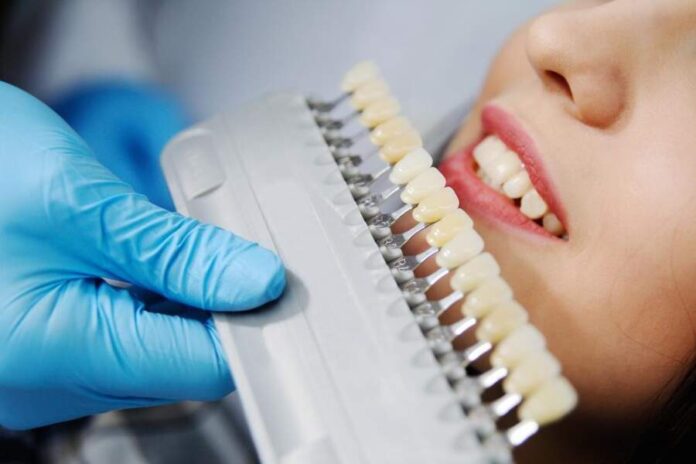 Caring for Your Dental Crown